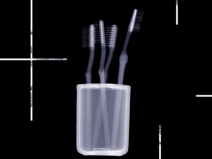 Stage IV oral cancer