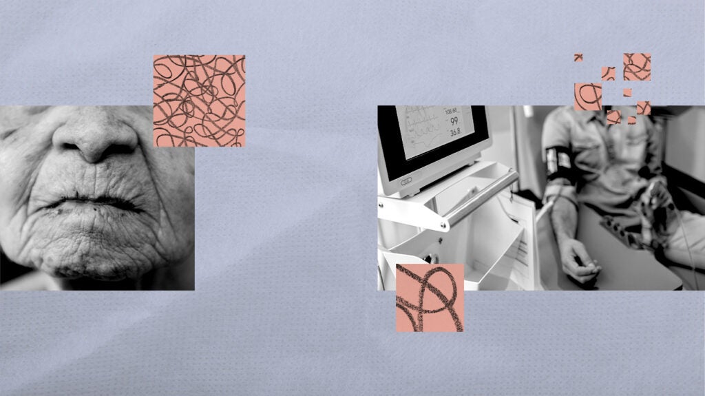 Immunotherapy for oral cancer