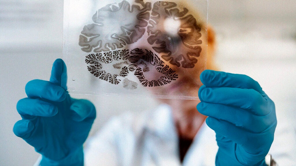 PLS vs. ALS: Symptoms, causes, and treatments