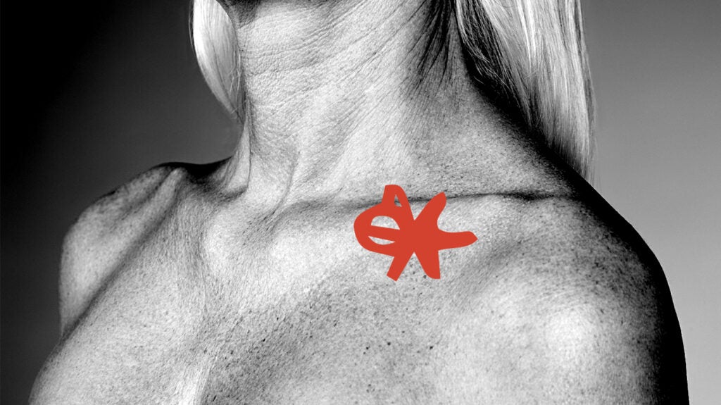 swollen supraclavicular lymph node after flu shot