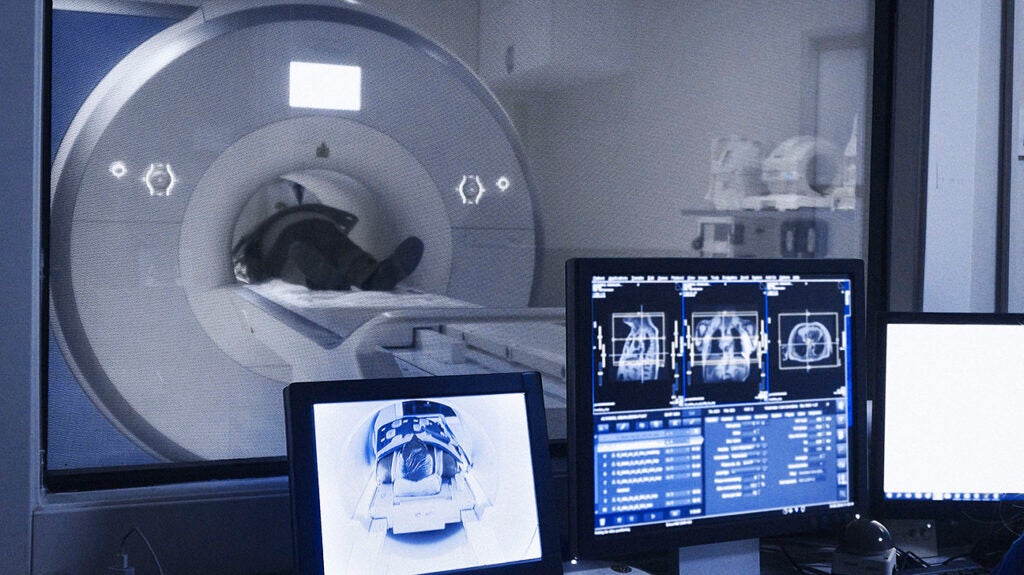 Abdominal lymphoma Symptoms, treatment, and outlook