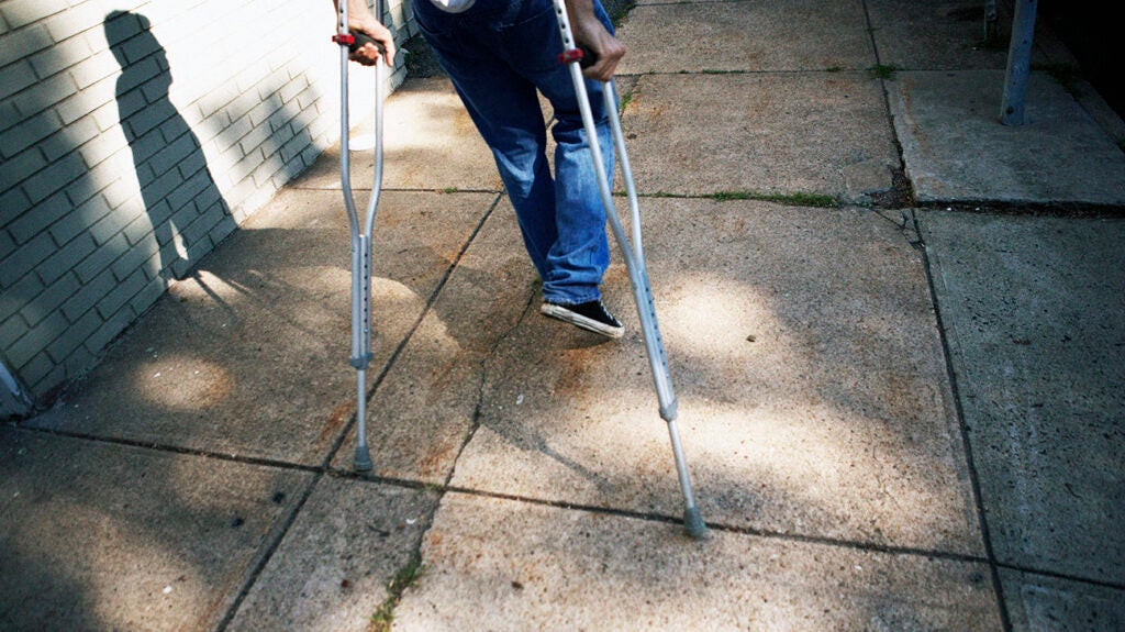 Ankle Fusion Recovery Timeline Physical Therapy Complications