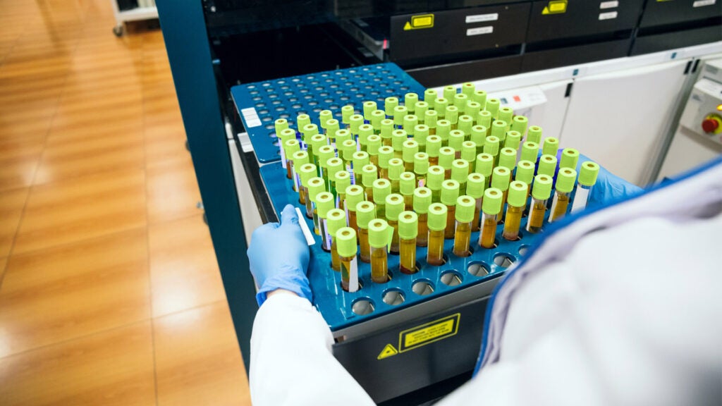 Colon cancer Lowering ammonia levels boosts tumor treatment