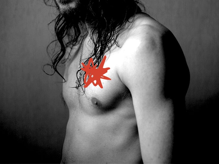 Chest pain after colonoscopy Possible causes and more