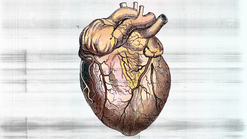 Diuretics for heart failure How they work and more