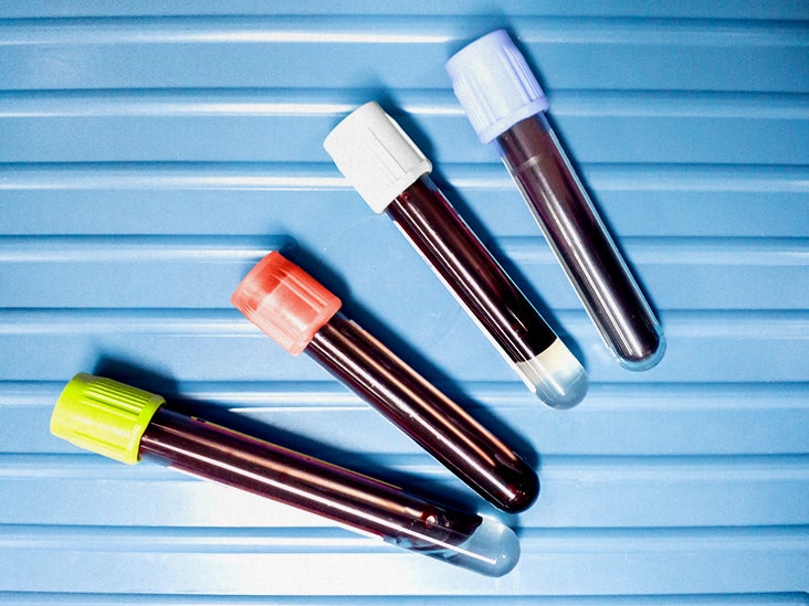 Leukemia platelet counts Levels and more