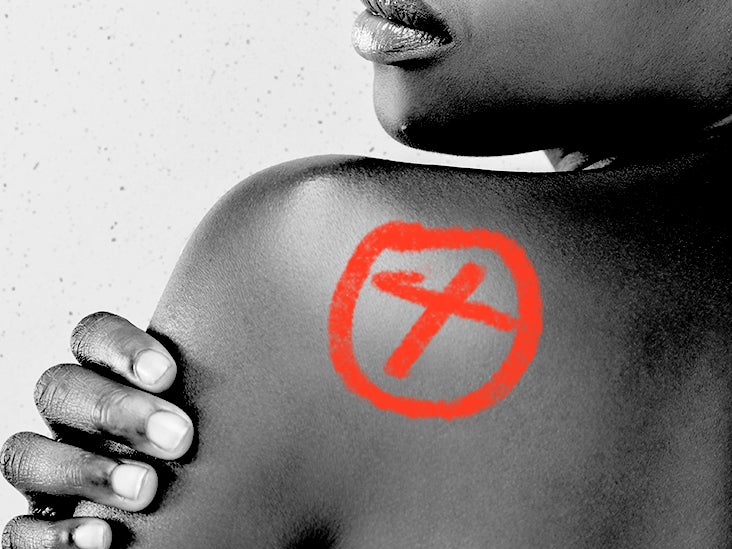 Causes of bullseyeshaped rash that are not Lyme disease