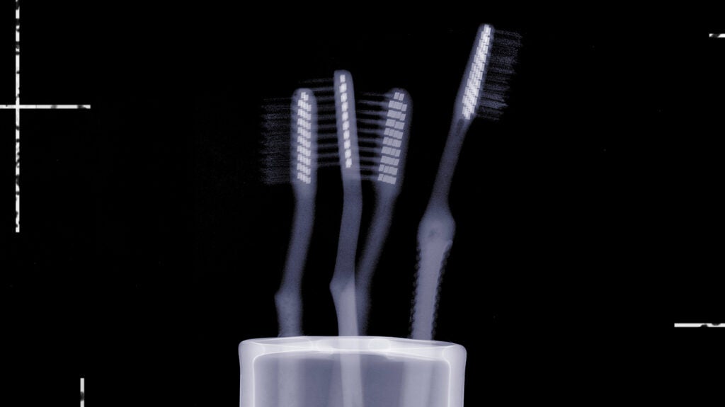 Stage IV oral cancer