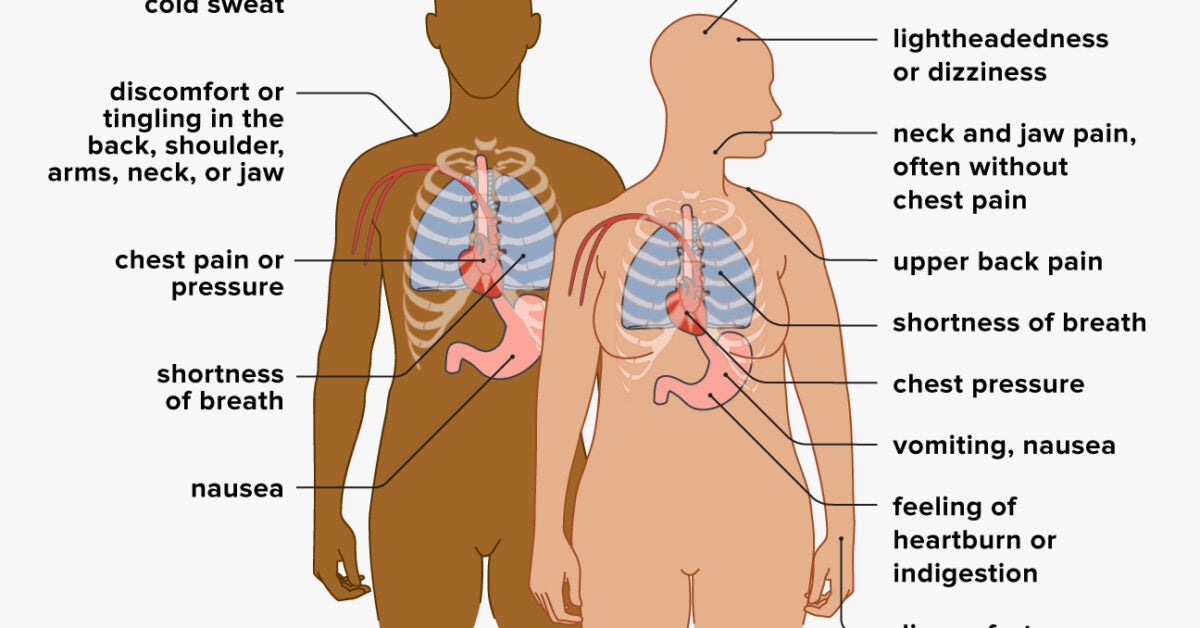 Is Your Chest Pain a Heart Attack or Something Else?: CA Heart and