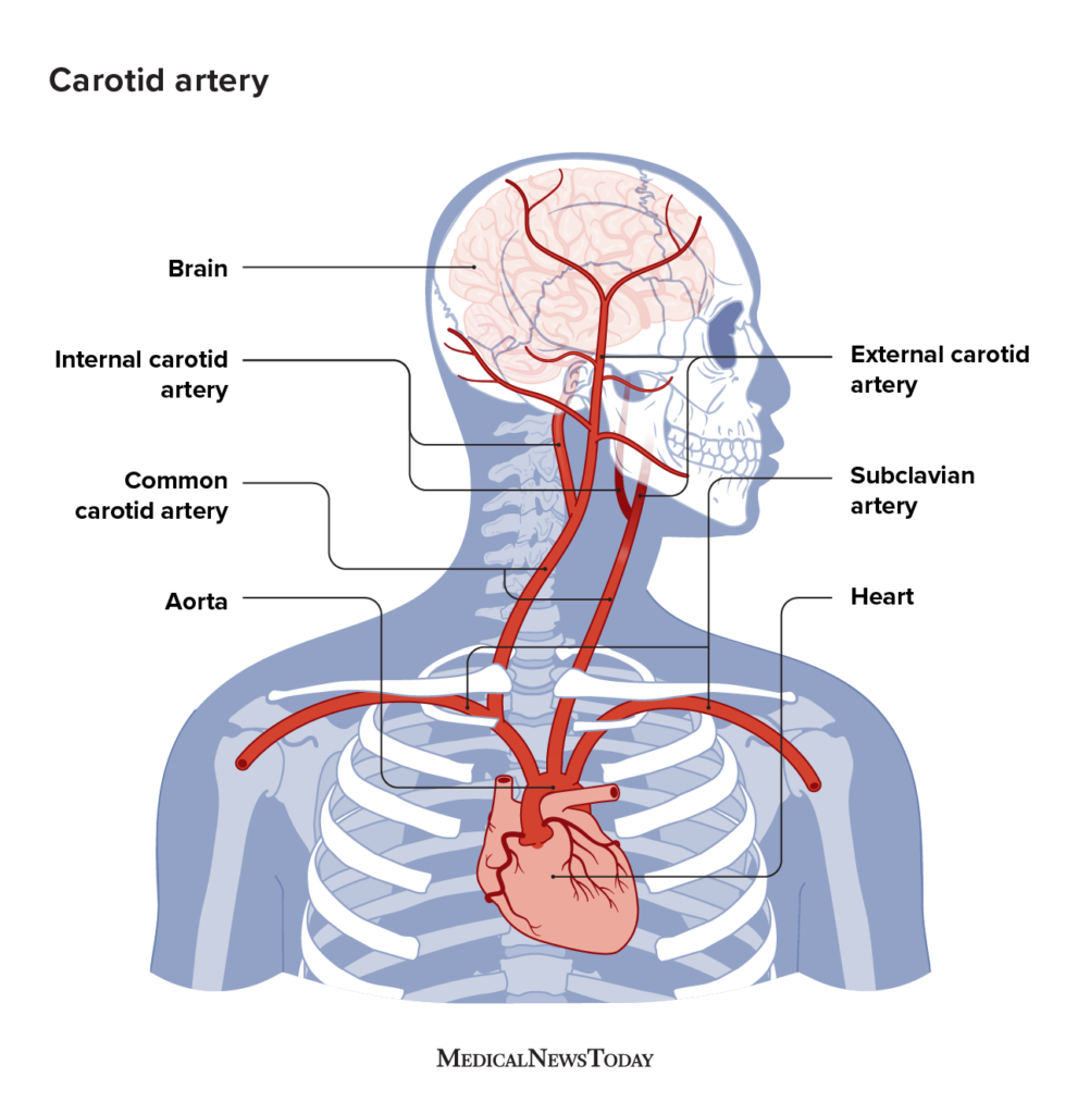 Carotid Artery Neck Pain Symptoms Causes And More