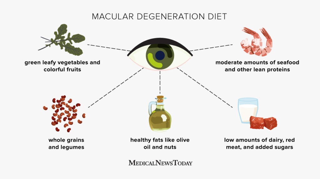 Macular degeneration diet Foods to eat and benefits