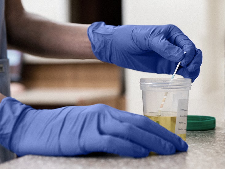 Le test peut aider à prédire la maladie des années avant les symptômes