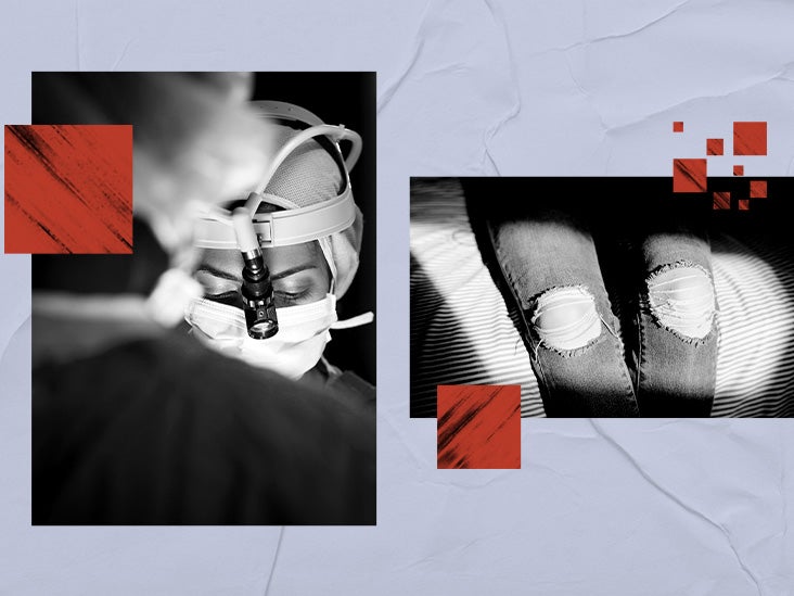 acl-reconstruction-surgery-procedure-preparation-recovery-and-more