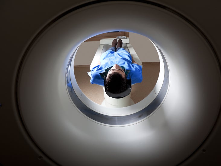 How is a PET scan used in chemotherapy?
