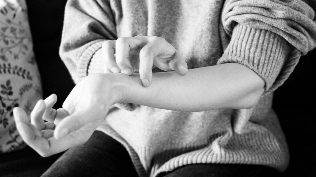 Can itchy skin be a sign of something serious?