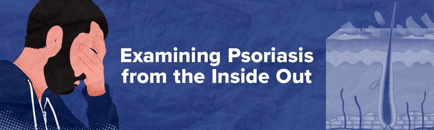 Examining Psoriasis From the Inside Out