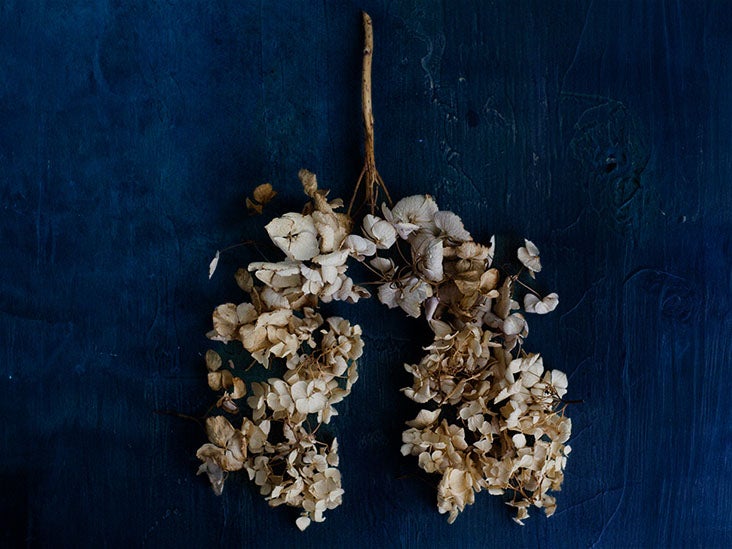 Dried Roses by Stocksy Contributor Crissy Mitchell - Stocksy