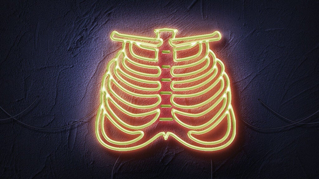 Bone cancer Can it develop in the ribs?