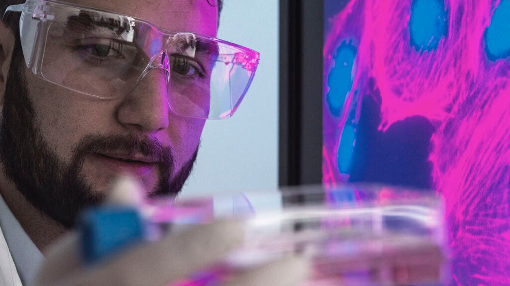 Stem cells for ulcerative colitis: Research and more