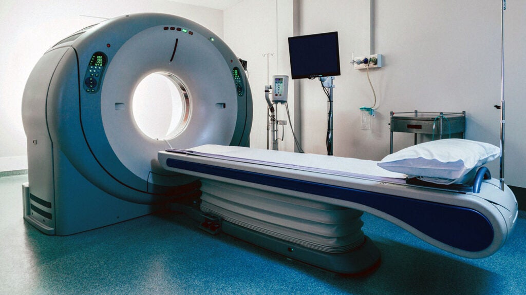 MRI for epilepsy: How it works and what it can show