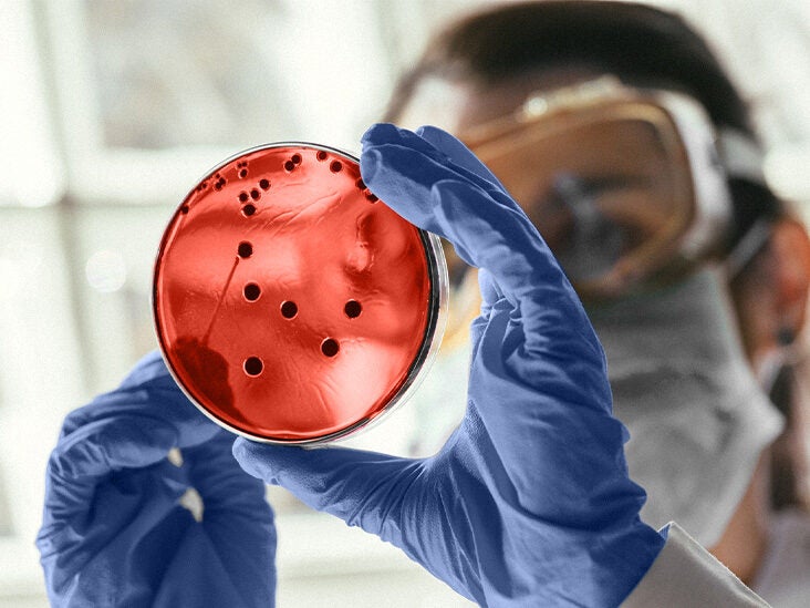 Kidney disease: Research may pave the way for gene therapy for ADPKD - Vimarsana News