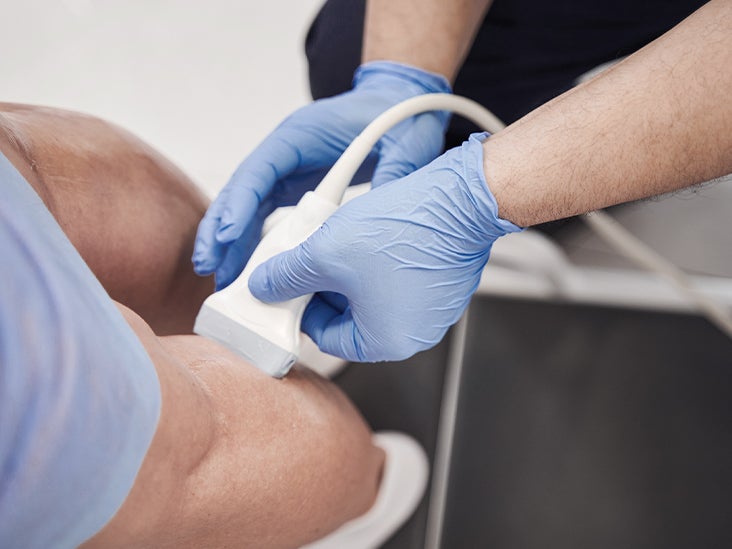 Deep Vein Thrombosis Diagnosis What To Know About Dvt Tests