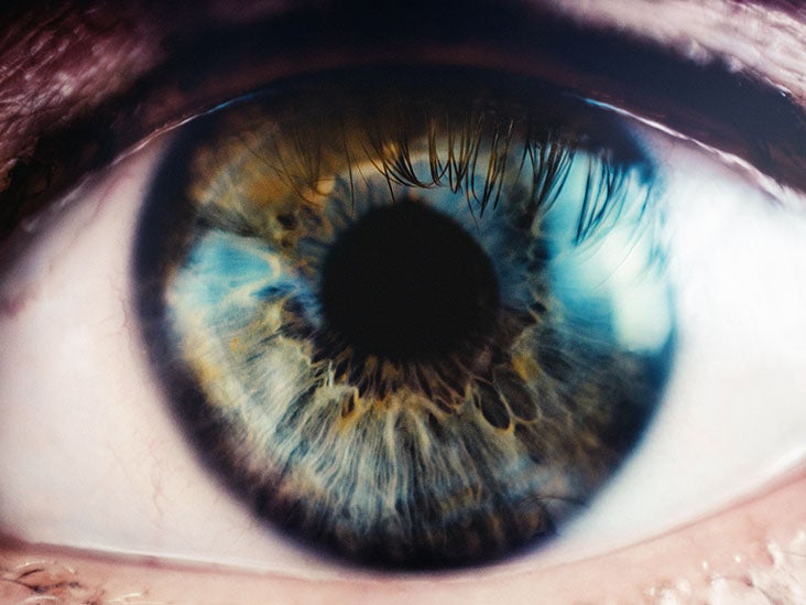 Eye treatment for Bell's palsy A guide