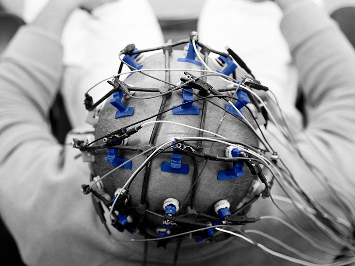 Parkinson's disease: Could an EEG test help predict cognitive decline? - Vimarsana News