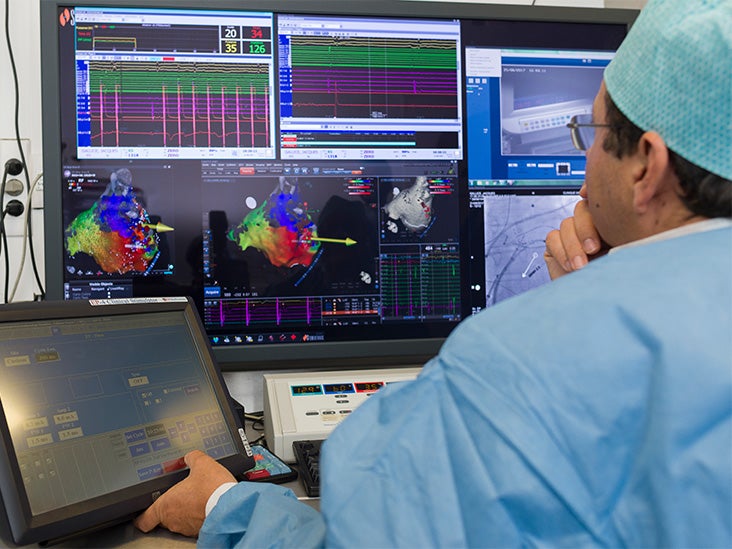 What is an electrophysiology procedure? What to know