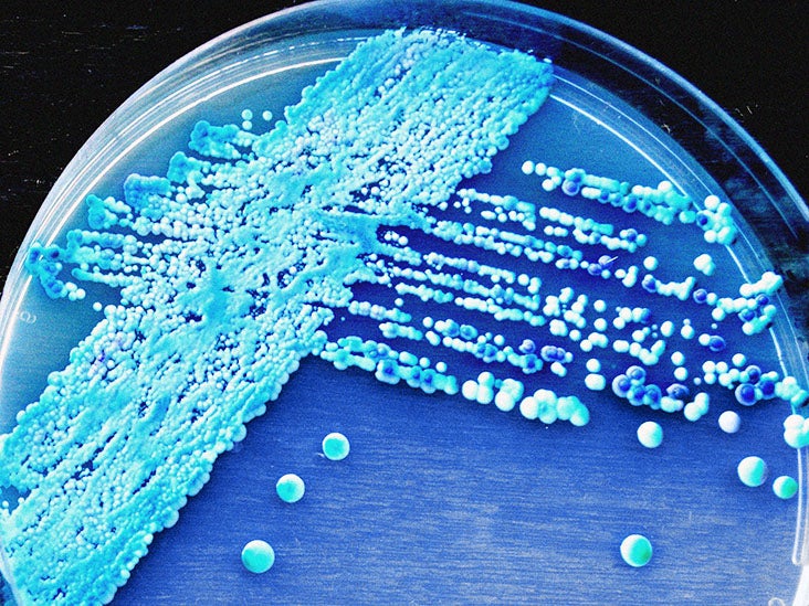 oral-thrush-and-hiv-what-is-the-connection