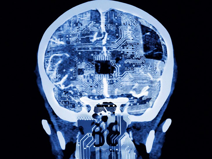 How new brain mapping technique may help improve epilepsy symptoms - Vimarsana News