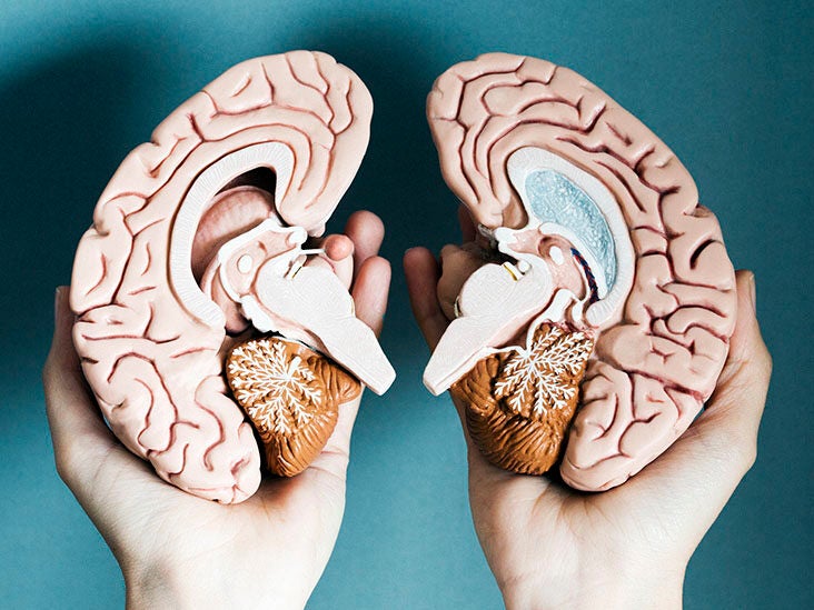 Multiple sclerosis: Brain barrier inflammation may play role - Vimarsana News