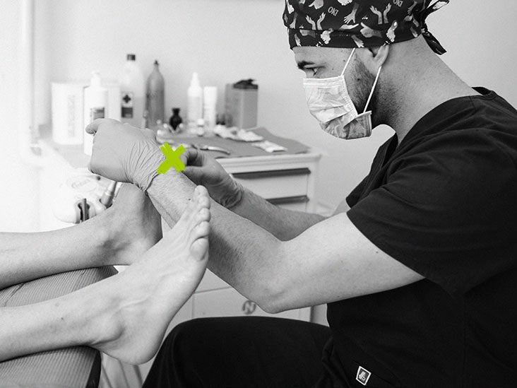 Gout vs bunion Symptoms, causes, treatment, and more