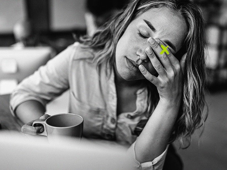 Lupus and dry eyes Understanding the link and getting help