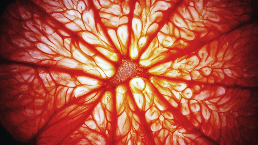 what-is-the-connection-between-vitamin-c-and-the-kidneys