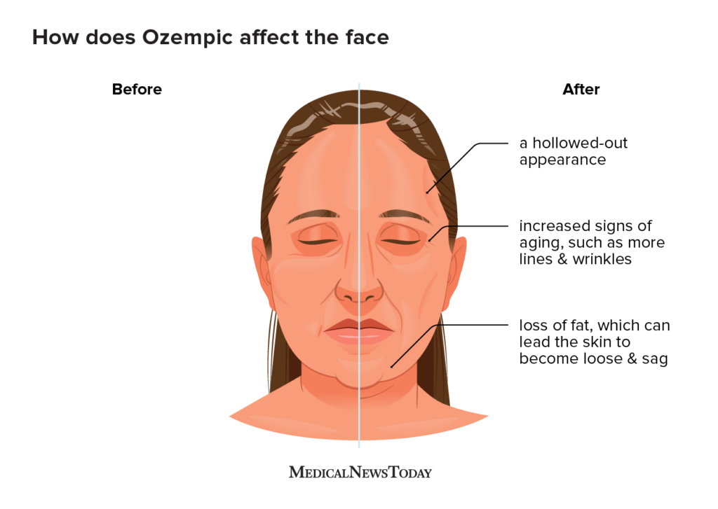 wrinkled face before and after