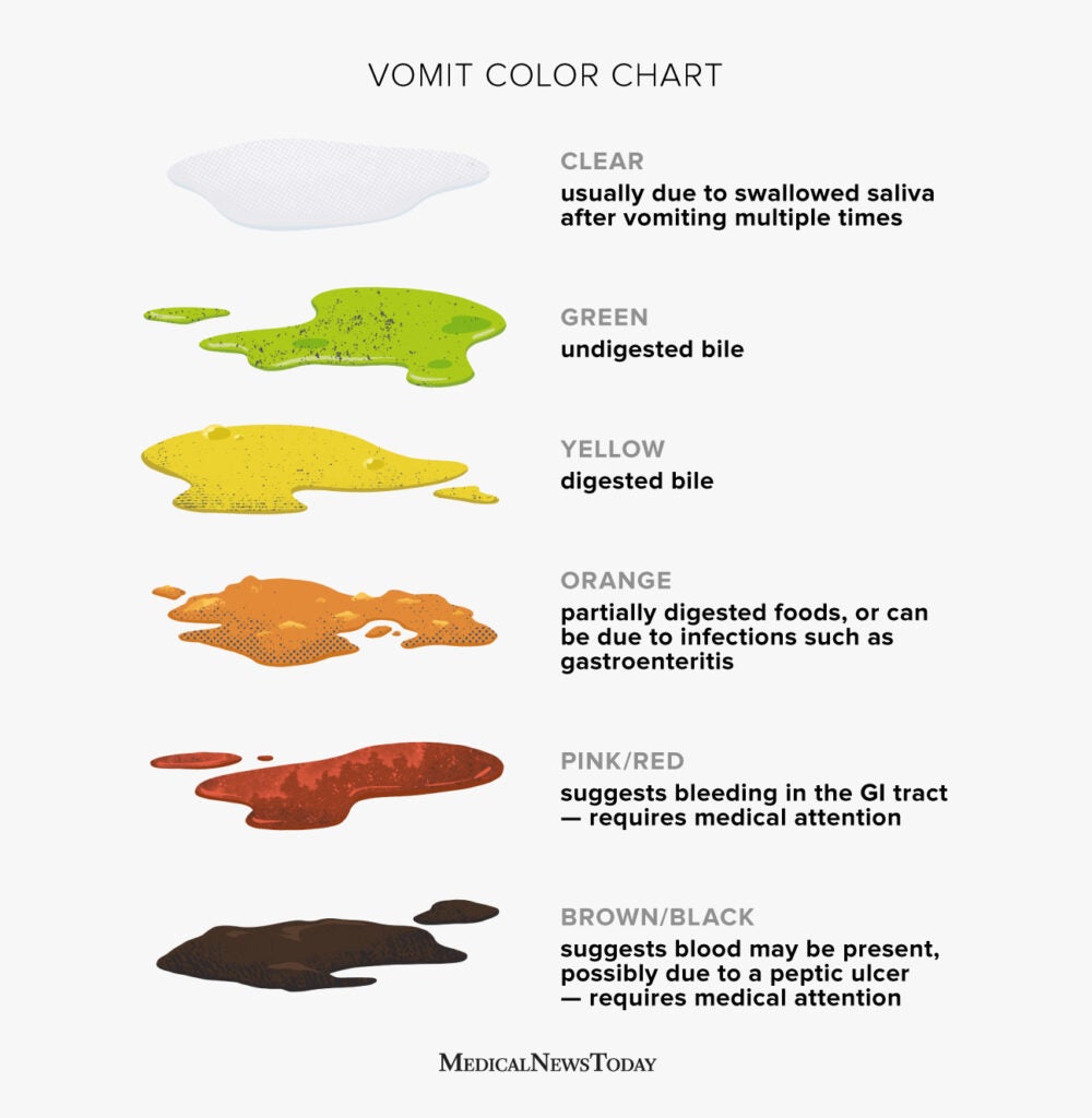 Vomit color chart: Clear, white, green, yellow, orange, red, and more