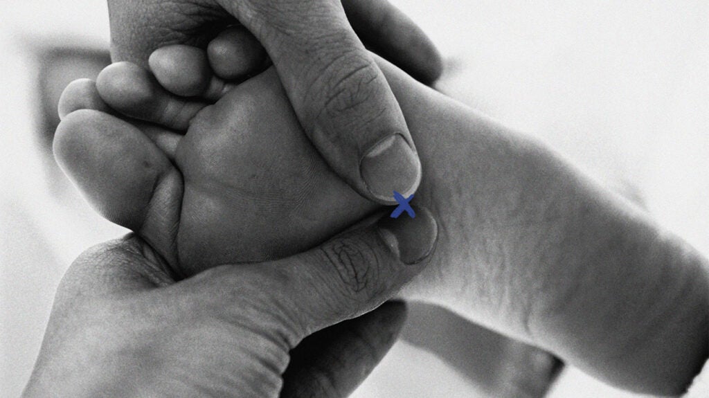 Acupressure Definition, benefits, and more