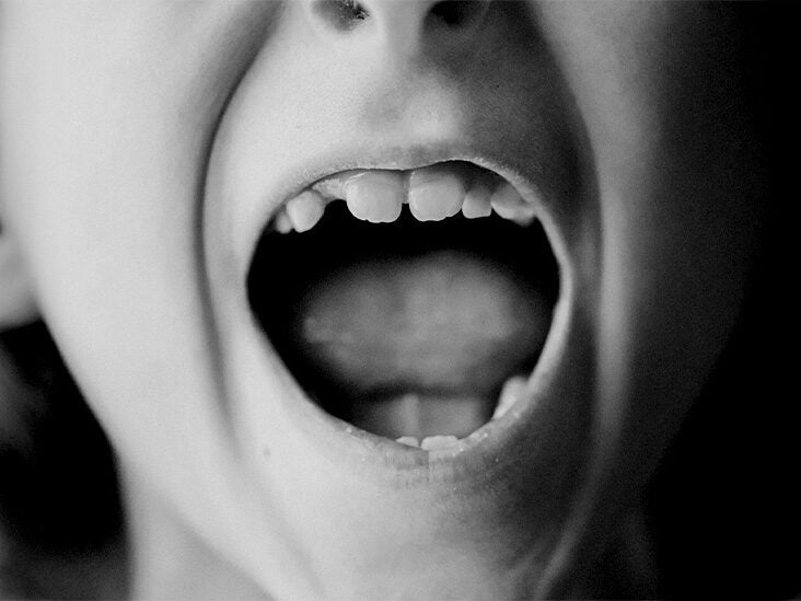 Roof Of Mouth Cancer