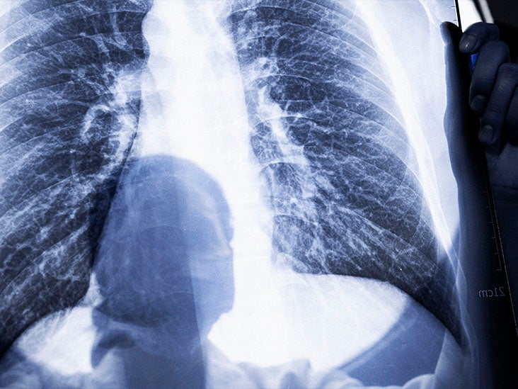 Right upper quadrant pain under the ribs 9 causes
