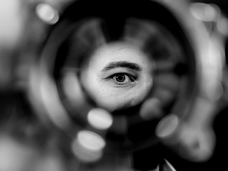 What to know about giant papillary conjunctivitis