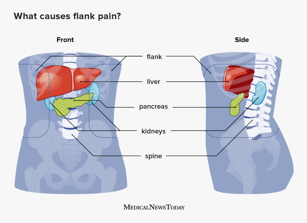 Other cause for acute flank pain