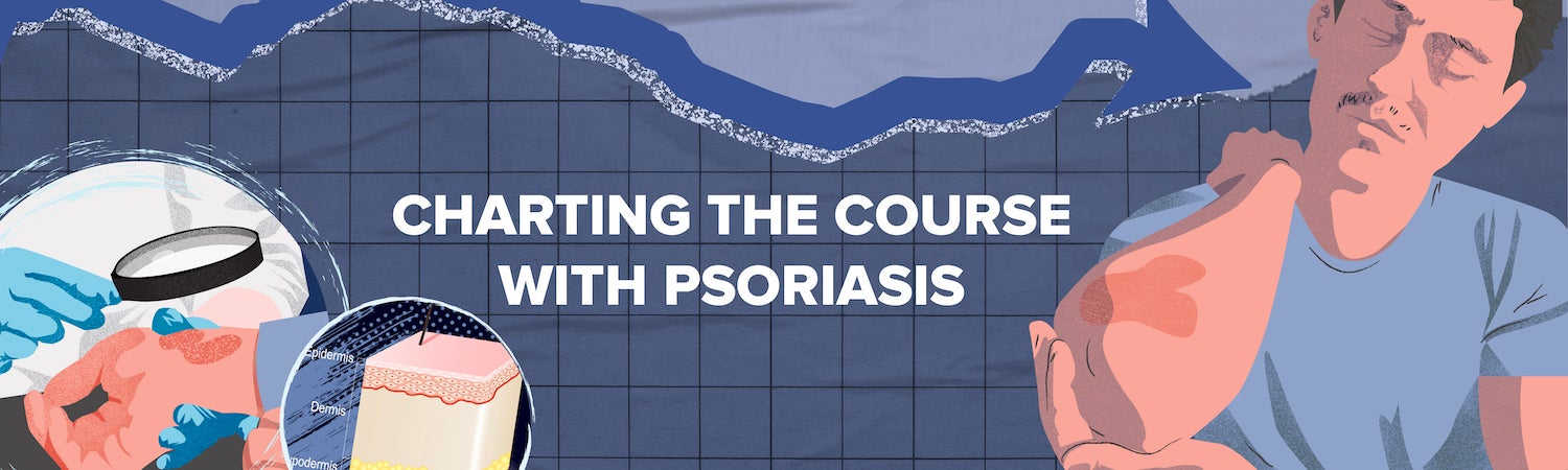 Charting the Course with Psoriasis