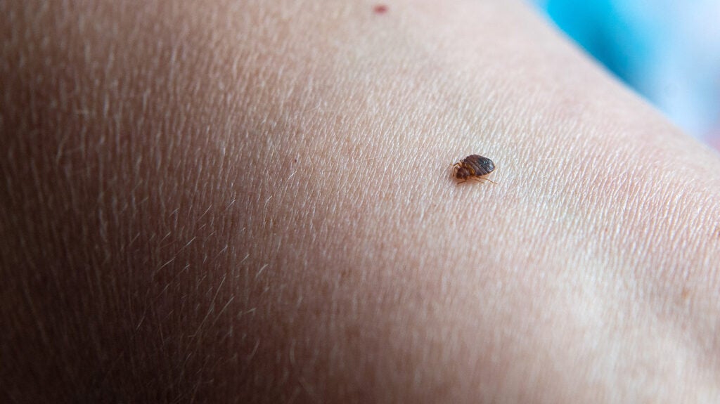 Spot on the breast: Bug bite, rash, cancer, or something else?