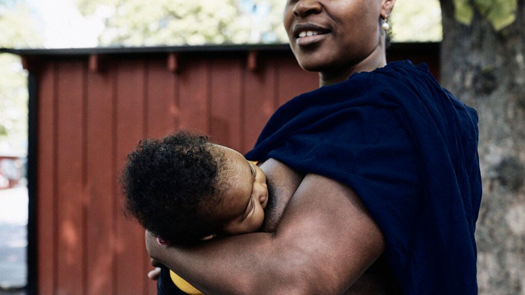 Eczema Researchers report link with gut health in babies