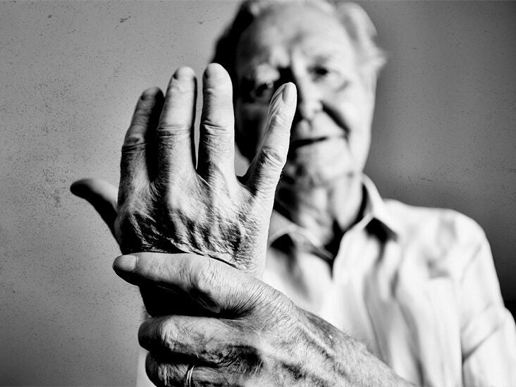 Osteoarthritis: Methotrexate may be an effective treatment - Vimarsana News