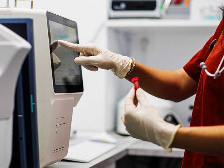 Lung cancer: New blood test may help detect disease earlier - Vimarsana News